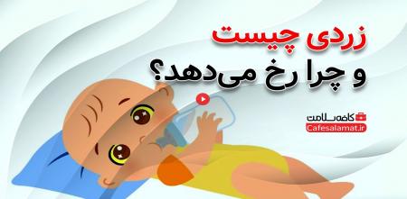 زردی چیست و چرا رخ می‌دهد؟