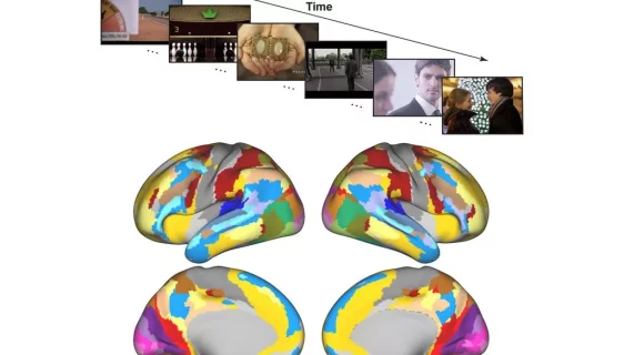 اسکن مغز fmri