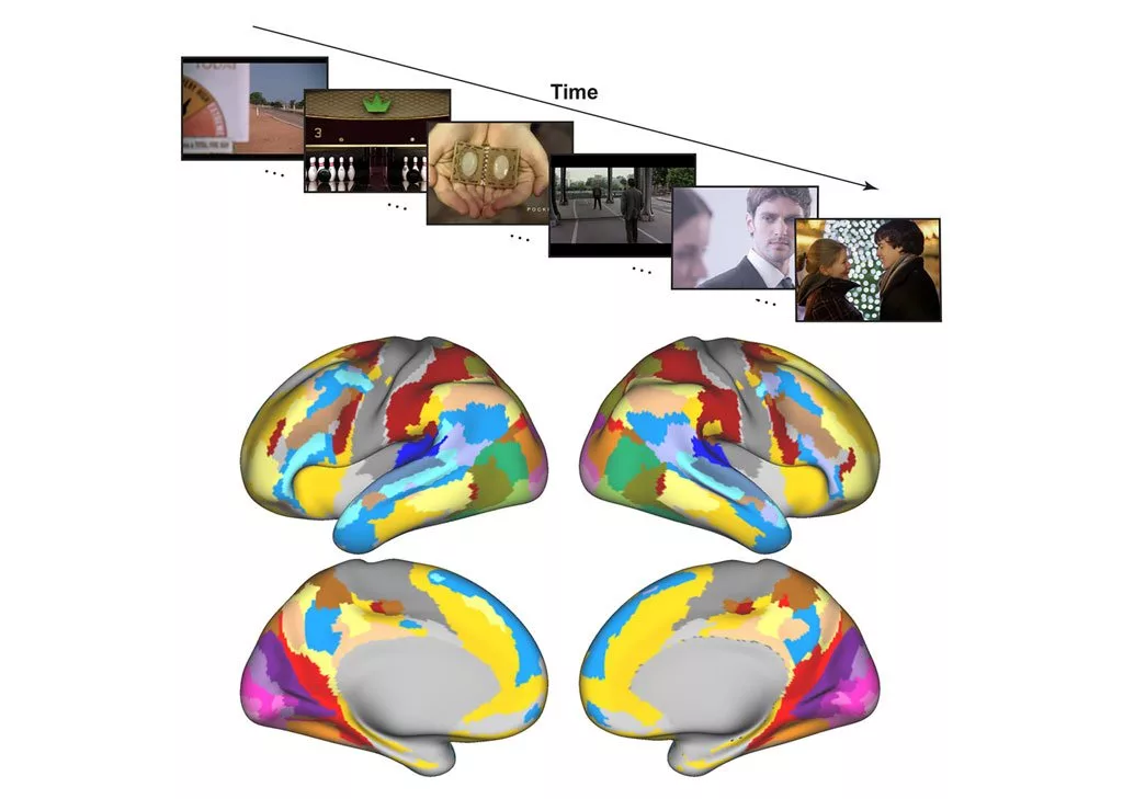 اسکن مغز fmri