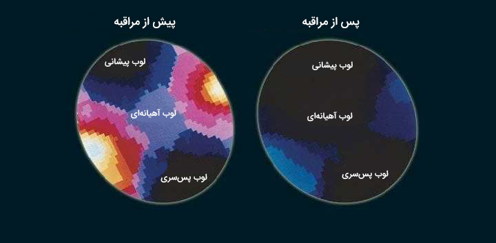 مراقبه چیست و چه اثری بر مغز و ذهن دارد؟ راهنمای کامل 14 مراقبه چیست ، تاثیر مراقبه بر مغز
