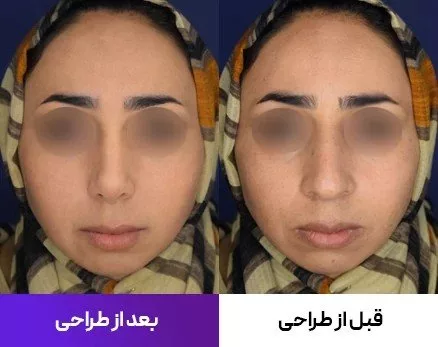1753269683 822 همانند‌سازی عمل بینی با هوش مصنوعی دیدانگار.webp